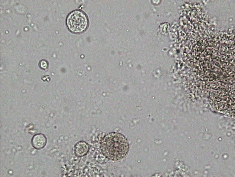 Stemonitis axifera?